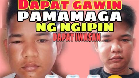 pag si clavio ang kumana yung puke magang maga|Kung paano mapupuksa ang namamaga mata dahil sa pag.